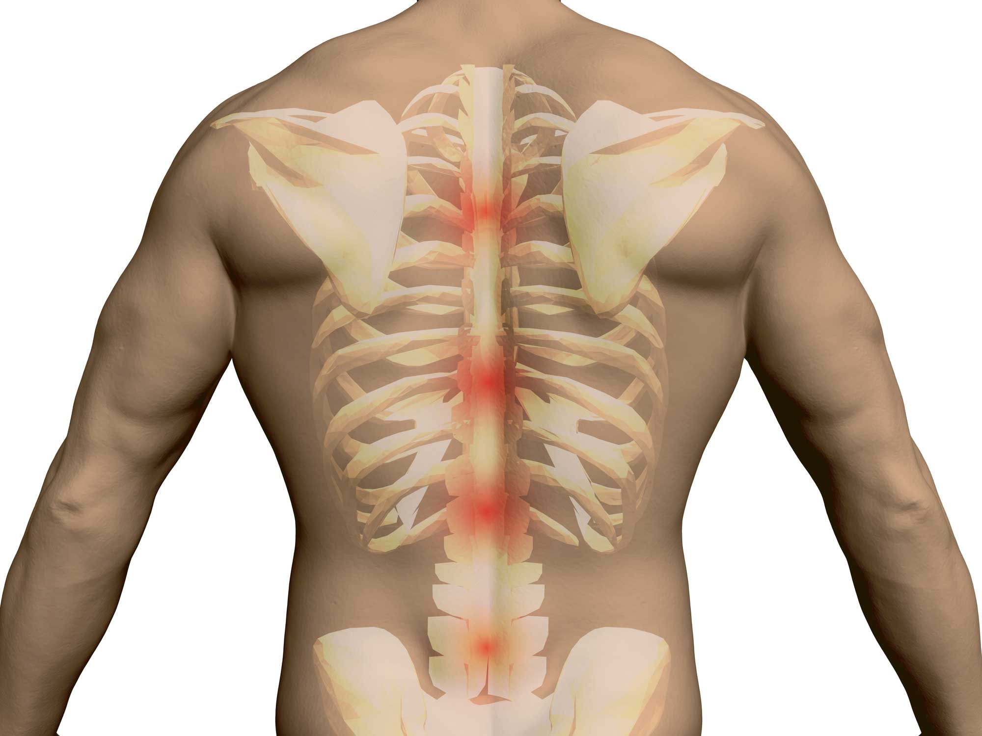 Spine Surgeon in Vijayawada